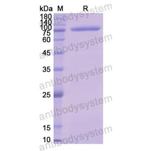 重组CD141/THBD蛋白,Recombinant Human CD141/THBD, N-GST