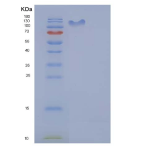 Recombinant Human UBE1 / UBA1 Protein (His & GST tag)