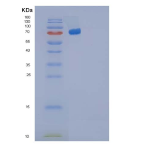 Recombinant Human IL-35 (IL12A &EBI3 Heterodimer) Protein (Fc Tag)