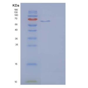 Recombinant Rat IL23R / IL23 Receptor Protein (Fc tag),Recombinant Rat IL23R / IL23 Receptor Protein (Fc tag)