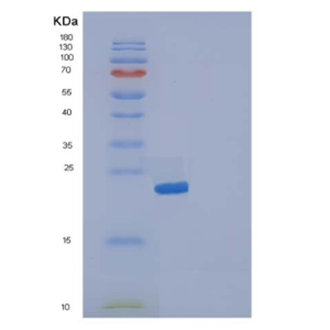 Recombinant Human IL19 / Interleukin-19 Protein (His tag),Recombinant Human IL19 / Interleukin-19 Protein (His tag)