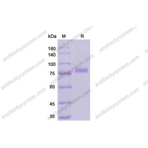 重组CD141/THBD蛋白,Recombinant Human CD141/THBD, C-His