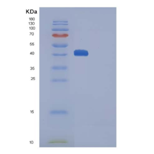 Recombinant Human CTLA4 / CD152 Protein (His & Fc tag)