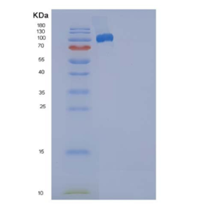 Recombinant Human SELP / selectin P / P-selectin Protein (Fc tag)