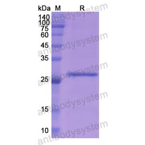 Recombinant Human ASGR1, N-His