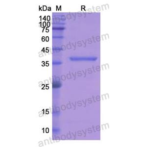 Recombinant Human ASGR2, N-His