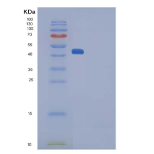 Recombinant Rat SerpinF1 / PEDF Protein (His Tag)