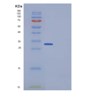 Recombinant Human DKK1 / Dkk-1 Protein (His tag)
