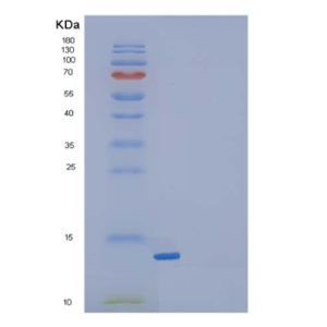 Recombinant Mouse Transforming Growth Factor β-1/TGFβ1/TGFB1 Protein,Recombinant Mouse Transforming Growth Factor β-1/TGFβ1/TGFB1 Protein