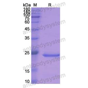 重组ADH1A蛋白,Recombinant Human ADH1A, N-His