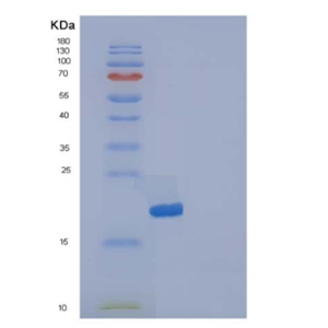 Recombinant Human IL1F5 / IL36RN Protein