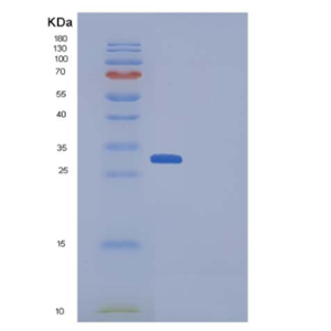 Recombinant Aequorea victoria GFP Protein (His Tag),Recombinant Aequorea victoria GFP Protein (His Tag)