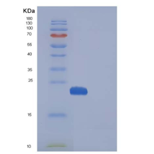 Recombinant Human MANF / ARMET Protein (His tag)