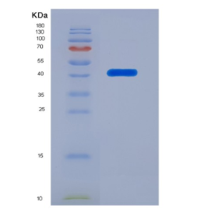 Eukaryotic B-Cell Activating Factor (BAFF),Eukaryotic B-Cell Activating Factor (BAFF)