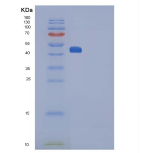 Recombinant Rat Interleukin 25 / IL25 / IL17E Protein (Fc tag)