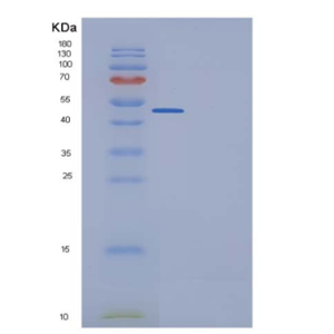 Recombinant Human Ephrin-B1 / EFNB1 Protein (His & Fc tag),Recombinant Human Ephrin-B1 / EFNB1 Protein (His & Fc tag)