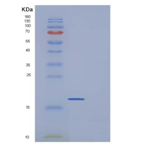 Recombinant Human IL17 / IL17A Protein (His tag)