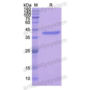 Recombinant Human ANXA2, N-His