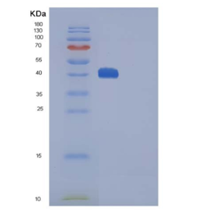 Recombinant Mouse CTLA4 / CD152 Protein (Fc tag)