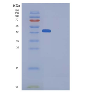 Recombinant Human HVEM / TNFRSF14 Protein (His & Fc tag)