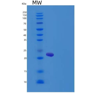 Recombinant Rat IL6 / Interleukin-6 Protein,Recombinant Rat IL6 / Interleukin-6 Protein