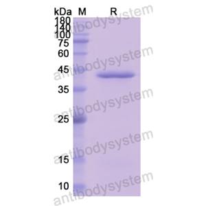 重组C8B蛋白,Recombinant Human C8B, N-His