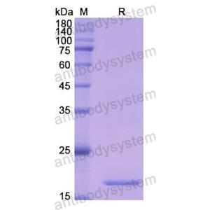 Recombinant Human CD42b/GP1BA, N-His