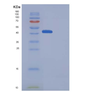 Recombinant Mouse CD70 / CD27L / TNFSF7 Protein (Fc Tag),Recombinant Mouse CD70 / CD27L / TNFSF7 Protein (Fc Tag)