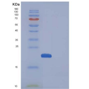Recombinant Mouse CDNF / ARMETL1 Protein (His tag)