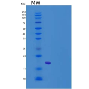 Recombinant Mouse MANF / ARMET Protein (His tag)