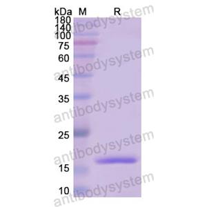 重组IVL蛋白,Recombinant Human IVL, N-His