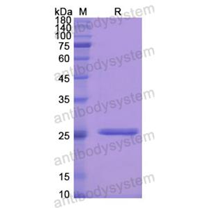 重組PRSS1蛋白,Recombinant Human PRSS1, N-His