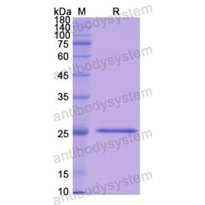 重組PRSS2蛋白,Recombinant Human PRSS2, N-His