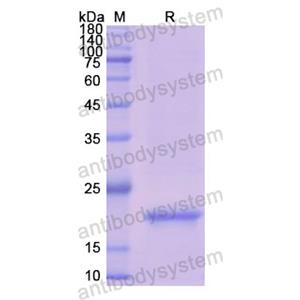 Recombinant Human CSN3, N-His