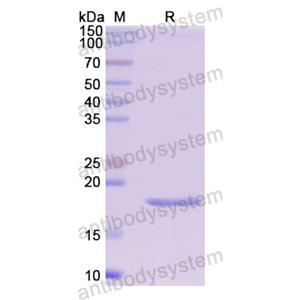 Recombinant Human HEXB, N-His