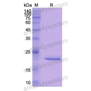 Recombinant Human CTSL, N-His