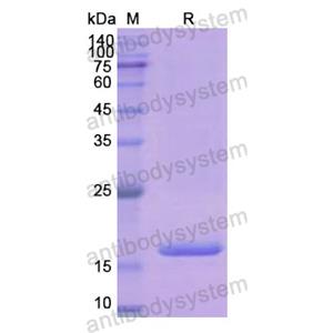 Recombinant Human PFN1, N-His