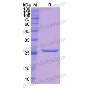 Recombinant Human BPGM, N-His