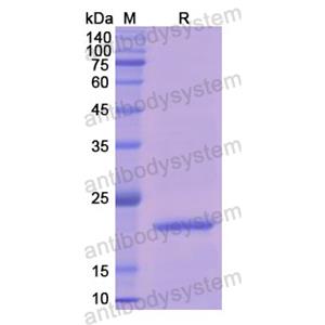 重組APRT蛋白,Recombinant Human APRT, N-His