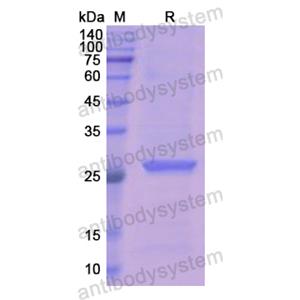 Recombinant Human LAMB1 Protein, N-His