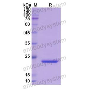 重組SFTPB蛋白,Recombinant Human SFTPB, N-His