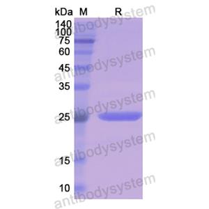 Recombinant Human CD271/NGFR, N-His