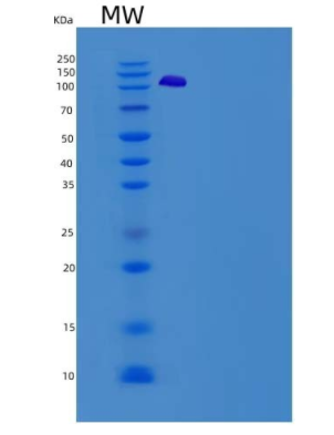 Recombinant Human VCL / Vinculin Protein (His tag),Recombinant Human VCL / Vinculin Protein (His tag)