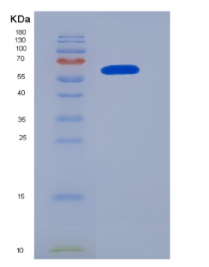 Eukaryotic Neuropilin 1 (NRP1),Eukaryotic Neuropilin 1 (NRP1)