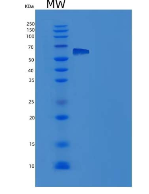 Recombinant Rat EphA4 Protein (His tag),Recombinant Rat EphA4 Protein (His tag)