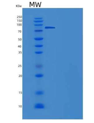 Recombinant Rat EphA4 Protein (Fc tag),Recombinant Rat EphA4 Protein (Fc tag)