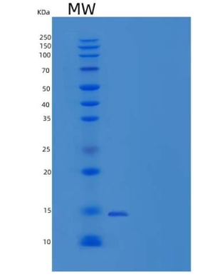 Recombinant Mouse FABP4 / ALBP / A-FABP / AFABP Protein (His tag),Recombinant Mouse FABP4 / ALBP / A-FABP / AFABP Protein (His tag)