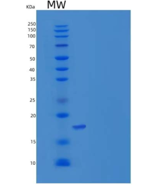 Recombinant Human REG1B / PSPS2 Protein (His tag),Recombinant Human REG1B / PSPS2 Protein (His tag)