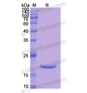 重组SERPINA6蛋白,Recombinant Human SERPINA6, N-His