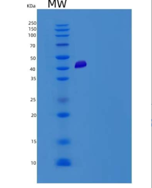 Recombinant Human ADCYAP1R1 Protein (Fc tag),Recombinant Human ADCYAP1R1 Protein (Fc tag)